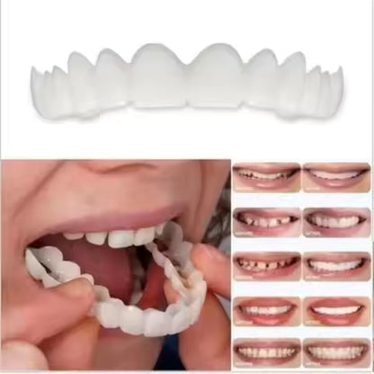 Adjustable Dental Veneers Unisex Teeth Veneer for Men and Women